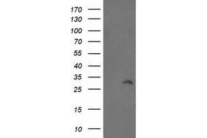 Western Blotting (WB) image for anti-Integral Membrane Protein 2B (ITM2B) antibody (ABIN1496395) (ITM2B Antikörper)