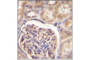 Immunohistochemistry analysis in formalin fixed and paraffin embedded human kidney tissue stained with CYP27B1 Antibody (C-term) Cat. (CYP27B1 Antikörper  (C-Term))