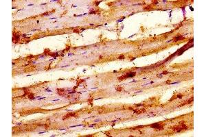 IHC image of ABIN7155352 diluted at 1:500 and staining in paraffin-embedded human skeletal muscle tissue performed on a Leica BondTM system. (MYSM1 Antikörper  (AA 170-311))