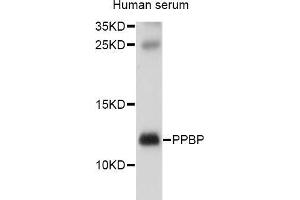 Western blot analysis of extracts of human serum, using PPBP antibody (ABIN5970990) at 1/1000 dilution. (CXCL7 Antikörper)