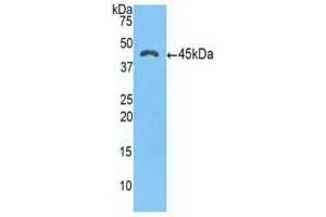 Detection of Recombinant a1ACT, Human using Polyclonal Antibody to Alpha-1-Antichymotrypsin (a1ACT) (SERPINA3 Antikörper  (AA 235-394))