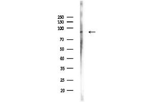 anti-Oxysterol Binding Protein-Like 1A (OSBPL1A) (C-Term) antibody