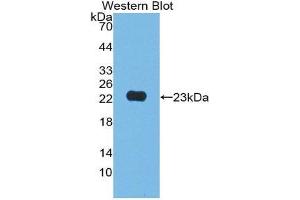 Western Blotting (WB) image for anti-Junctional Adhesion Molecule 2 (JAM2) (AA 74-250) antibody (ABIN1868793) (JAM2 Antikörper  (AA 74-250))