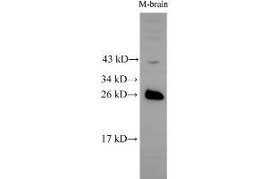 Western Blot analysis of Mouse brain tissue using RAB5B Polyclonal Antibody at dilution of 1:500 (RAB5B Antikörper)