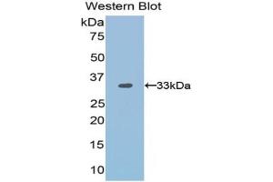 Western blot analysis of the recombinant protein. (OTUB1 Antikörper  (AA 1-271))