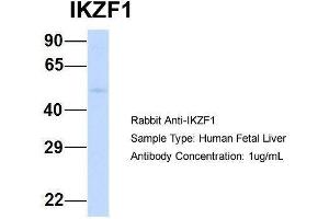 Host:  Rabbit  Target Name:  IKZF1  Sample Type:  Human Fetal Liver  Antibody Dilution:  1. (IKZF1 Antikörper  (Middle Region))