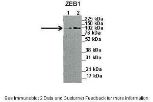 Lanes:   1. (ZEB1 Antikörper  (N-Term))