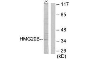 Western blot analysis of extracts from Jurkat cells, using HMG20B Antibody.