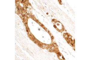 Immunohistochemistry (IHC) image for anti-Stratifin (SFN) (AA 198-248) antibody (ABIN7454767) (14-3-3 sigma/SFN Antikörper  (AA 198-248))