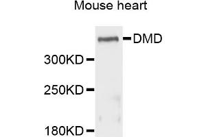Western blot analysis of extracts of mouse heart cells, using DMD antibody. (Dystrophin Antikörper)