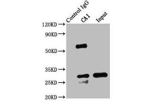 Immunoprecipitating CA1 in K562 whole cell lysate Lane 1: Rabbit control IgG instead of ABIN7146698 in K562 whole cell lysate. (CA1 Antikörper  (AA 2-261))