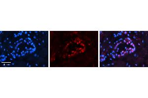 Rabbit Anti-PAX8 Antibody   Formalin Fixed Paraffin Embedded Tissue: Human Thyroid Tissue Observed Staining: Nucleus in follicular cells Primary Antibody Concentration: 1:100 Other Working Concentrations: 1:600 Secondary Antibody: Donkey anti-Rabbit-Cy3 Secondary Antibody Concentration: 1:200 Magnification: 20X Exposure Time: 0. (PAX8 Antikörper  (N-Term))
