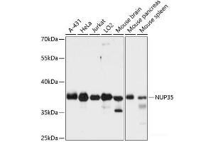 Western blot analysis of extracts of various cell lines using NUP35 Polyclonal Antibody at dilution of 1:3000. (NUP35 Antikörper)