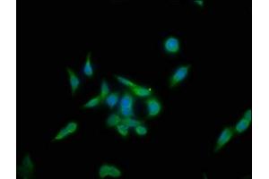 Immunofluorescence staining of PC-3 cells with ABIN7157267 at 1:133, counter-stained with DAPI. (KLHL12 Antikörper  (AA 1-220))