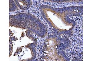 IHC analysis of GOLGA3 using anti-GOLGA3 antibody (ABIN7600298).