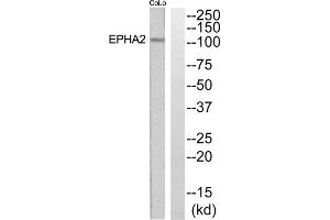Western blot analysis of extracts from COLO205 and Jurkat cells, using EPHA2 antibody. (EPH Receptor A2 Antikörper  (N-Term))