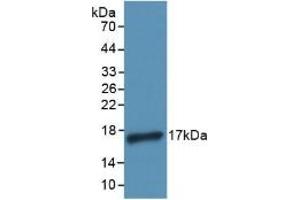 Detection of Recombinant IL4, Human using Polyclonal Antibody to Interleukin 4 (IL4)