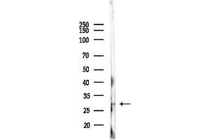 anti-NK2 Homeobox 5 (NKX2-5) (Internal Region) antibody