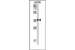 Image no. 1 for anti-Polymerase (RNA) I Polypeptide C, 30kDa (POLR1C) (C-Term) antibody (ABIN358013) (POLR1C Antikörper  (C-Term))