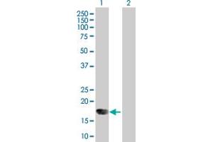 Western Blot analysis of IFNA6 expression in transfected 293T cell line by IFNA6 MaxPab polyclonal antibody. (IFNA6 Antikörper  (AA 1-189))
