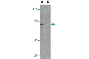 Western blot analysis of AICDA in Ramos whole cell lysate with AICDA polyclonal antibody  at 2 ug/mL in either the (A) absence or (B) presence of blocking peptide.