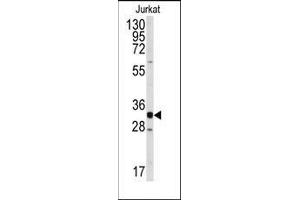 Western blot analysis of anti-CDK2 Antibody (C-term) in Jurkat cell line lysates (35ug/lane). (CDK2 Antikörper  (C-Term))