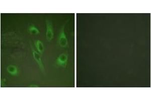 Immunofluorescence analysis of HeLa cells, using Calnexin (Phospho-Ser583) Antibody. (Calnexin Antikörper  (pSer583))