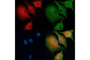 ABIN6265644 and ABIN6266780 staining  cells by IF/ICC.