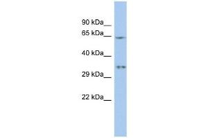 MIF4GD antibody used at 1 ug/ml to detect target protein. (MIF4GD Antikörper  (N-Term))
