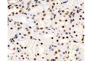 Immunohistochemistry analysis of paraffin-embedded Rat kidney using S100A4 Polyclonal Antibody at dilution of 1:400. (s100a4 Antikörper)