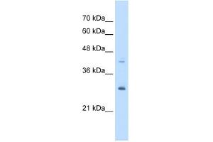 WB Suggested Anti-CACYBP Antibody Titration:  5.