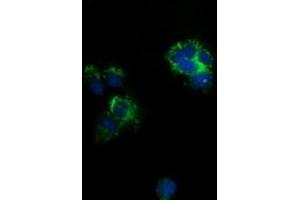 Anti-CLPP mouse monoclonal antibody (ABIN2452911) immunofluorescent staining of COS7 cells transiently transfected by pCMV6-ENTRY CLPP (RC200301). (CLPP Antikörper)