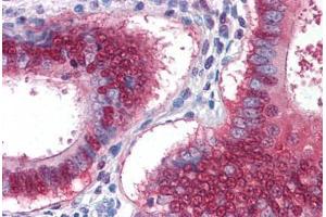 Human Uterus: Formalin-Fixed, Paraffin-Embedded (FFPE) (YAP1 Antikörper  (AA 53-162))