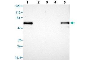 Western blot analysis of Lane 1: RT-4, Lane 2: U-251 MG, Lane 3: Human Plasma, Lane 4: Liver, Lane 5: Tonsil with LRMP polyclonal antibody .