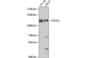 Western blot analysis of extracts of various cell lines, using DDX11 antibody (ABIN6130249, ABIN6139479, ABIN6139480 and ABIN6223588) at 1:1000 dilution. (DDX11 Antikörper  (AA 1-220))