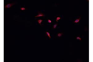 ABIN6268885 staining A-431 cells by IF/ICC. (HSPH1 Antikörper  (C-Term))