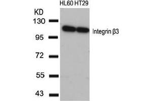 Image no. 3 for anti-Integrin beta 3 (ITGB3) (AA 771-775) antibody (ABIN197246) (Integrin beta 3 Antikörper  (AA 771-775))