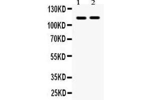 Anti- Eph receptor A5 Picoband antibody, Western blottingAll lanes: Anti Eph receptor A5  at 0.
