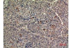 Immunohistochemical analysis of paraffin-embedded human-liver, antibody was diluted at 1:100. (TPO (Internal Region) Antikörper)