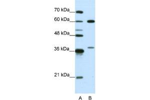 HNRNPL anticorps  (N-Term)