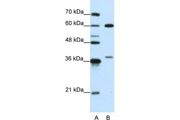 HNRNPL anticorps  (N-Term)
