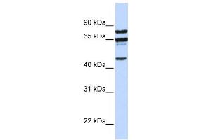 Western Blotting (WB) image for anti-Protein Phosphatase 4, Regulatory Subunit 2 (PPP4R2) antibody (ABIN2458684) (PPP4R2 Antikörper)