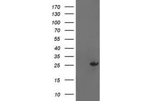 HEK293T cells were transfected with the pCMV6-ENTRY control (Left lane) or pCMV6-ENTRY AK4 (Right lane) cDNA for 48 hrs and lysed. (AK4 Antikörper)