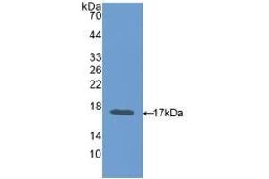 Detection of Recombinant CEA, Mouse using Polyclonal Antibody to Carcinoembryonic Antigen (CEA) (CEA Antikörper  (AA 85-222))