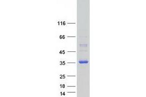 Western Blotting (WB) image for DnaJ (Hsp40) Homolog, Subfamily C, Member 12 (DNAJC12) (Transcript Variant 1) protein (Myc-DYKDDDDK Tag) (ABIN2719598)