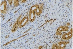 ABIN6276508 at 1/100 staining Human uterus tissue by IHC-P. (SPINK1 Antikörper  (Internal Region))