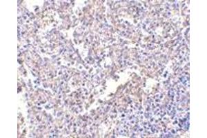 Immunohistochemistry (IHC) image for anti-Lymphocyte Antigen 96 (LY96) antibody (ABIN1031731) (LY96 Antikörper)