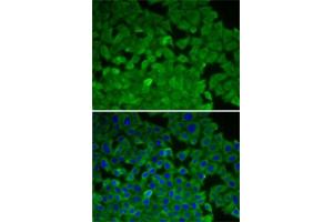 Immunofluorescence analysis of A-549 cells using EEF2K antibody (ABIN6130354, ABIN6139955, ABIN6139956 and ABIN7101771).