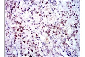 Immunohistochemistry (IHC) image for anti-Cyclin-Dependent Kinase 2 (CDK2) antibody (ABIN1845617) (CDK2 Antikörper)