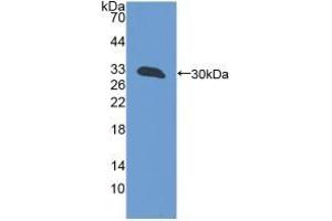 Detection of Recombinant GFM1, Mouse using Polyclonal Antibody to G-Elongation Factor, Mitochondrial 1 (GFM1)